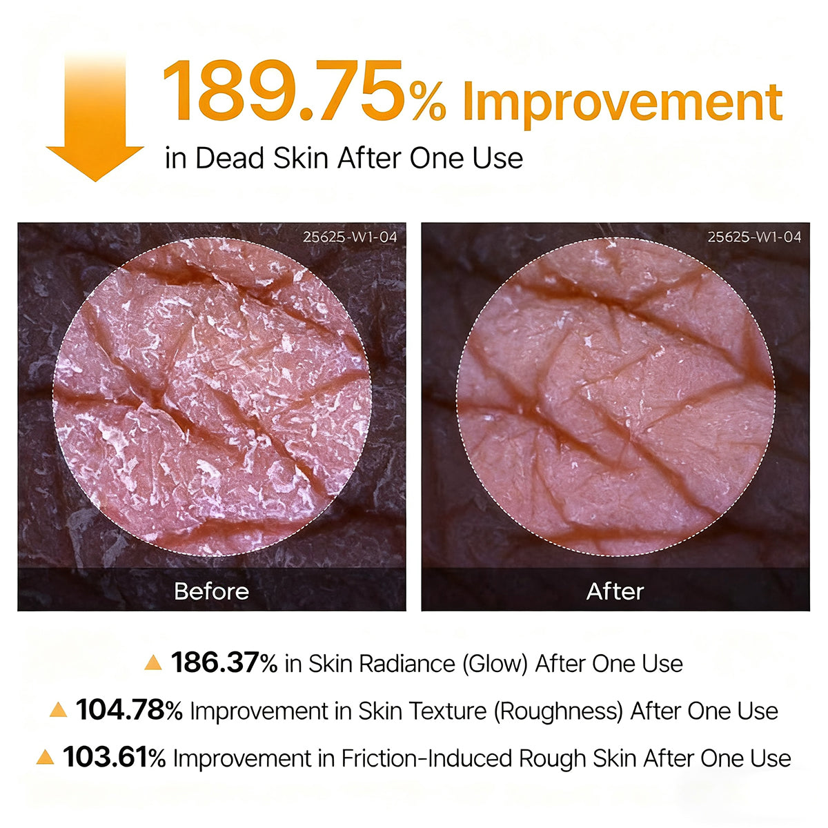 ๐ธ New! Peeling Shot Keratin Care Kojic Acid Turmeric Spray